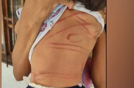 La brutal agresión sufrida por un niño de dos años causa conmoción en Bolivia